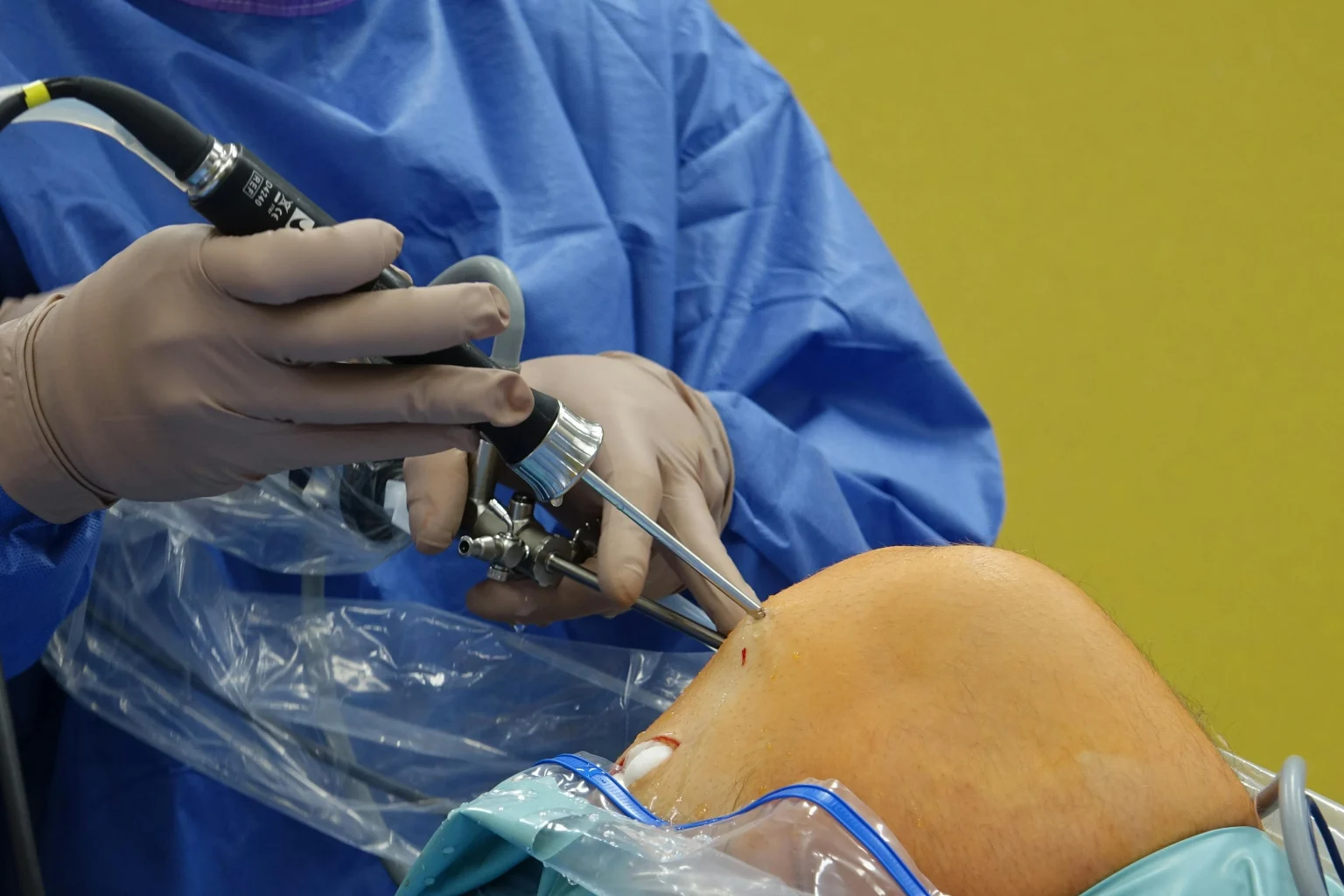 can i travel after knee surgery
